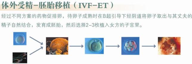 第一代试管婴儿治疗流程说明