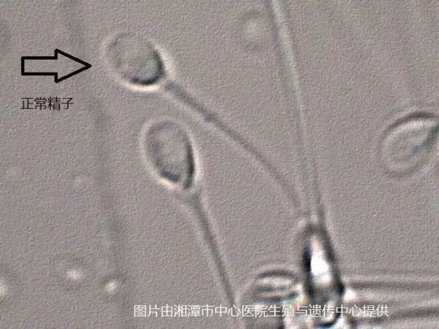 IMSI技术放大7200倍的精子形态